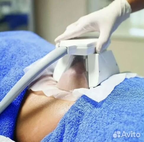 Липосакция аппаратная. Криолиполиз