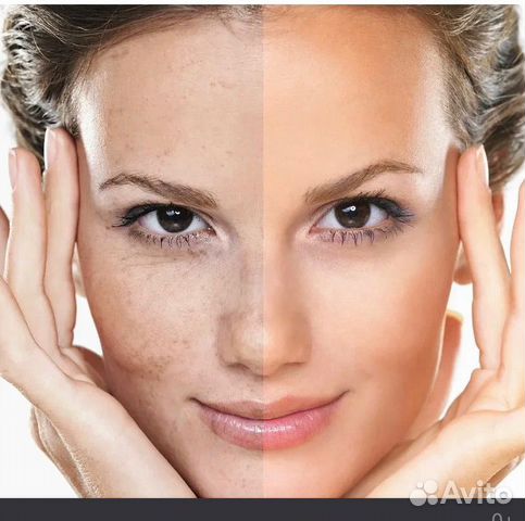 Morpheus 8 RF lifting #1 в мире