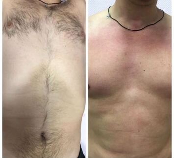 Мужская и женская депиляция воском и сахаром