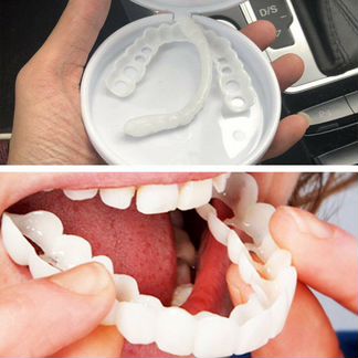 Виниры Snap-On Smile